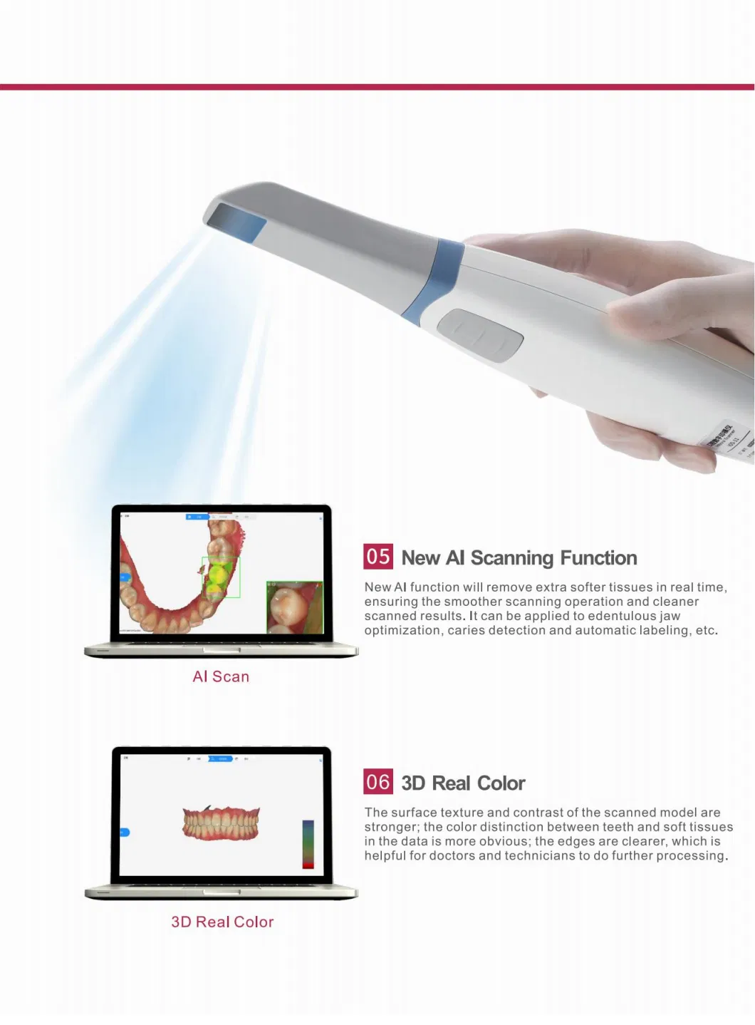 Dental Oral Scanner Digital 3D Scanner for Implant Orthodontics Restoration