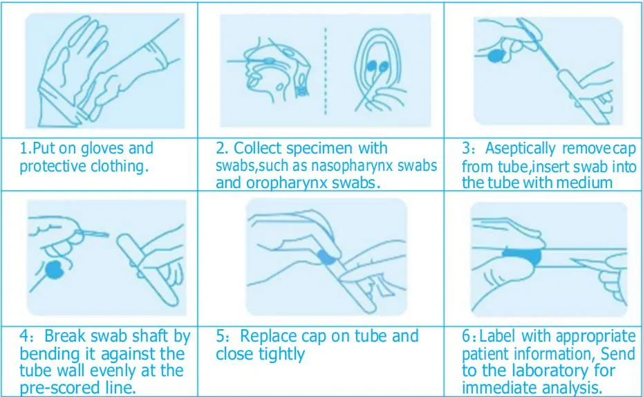 Nasopharyngeal Swab Eua Throat Swab Vtm Tube Virus Transport Tube